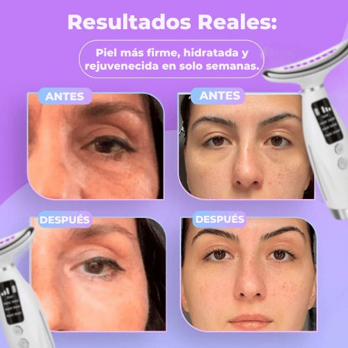 Masajeador facial PRO-GlowLift™ Facial 💎